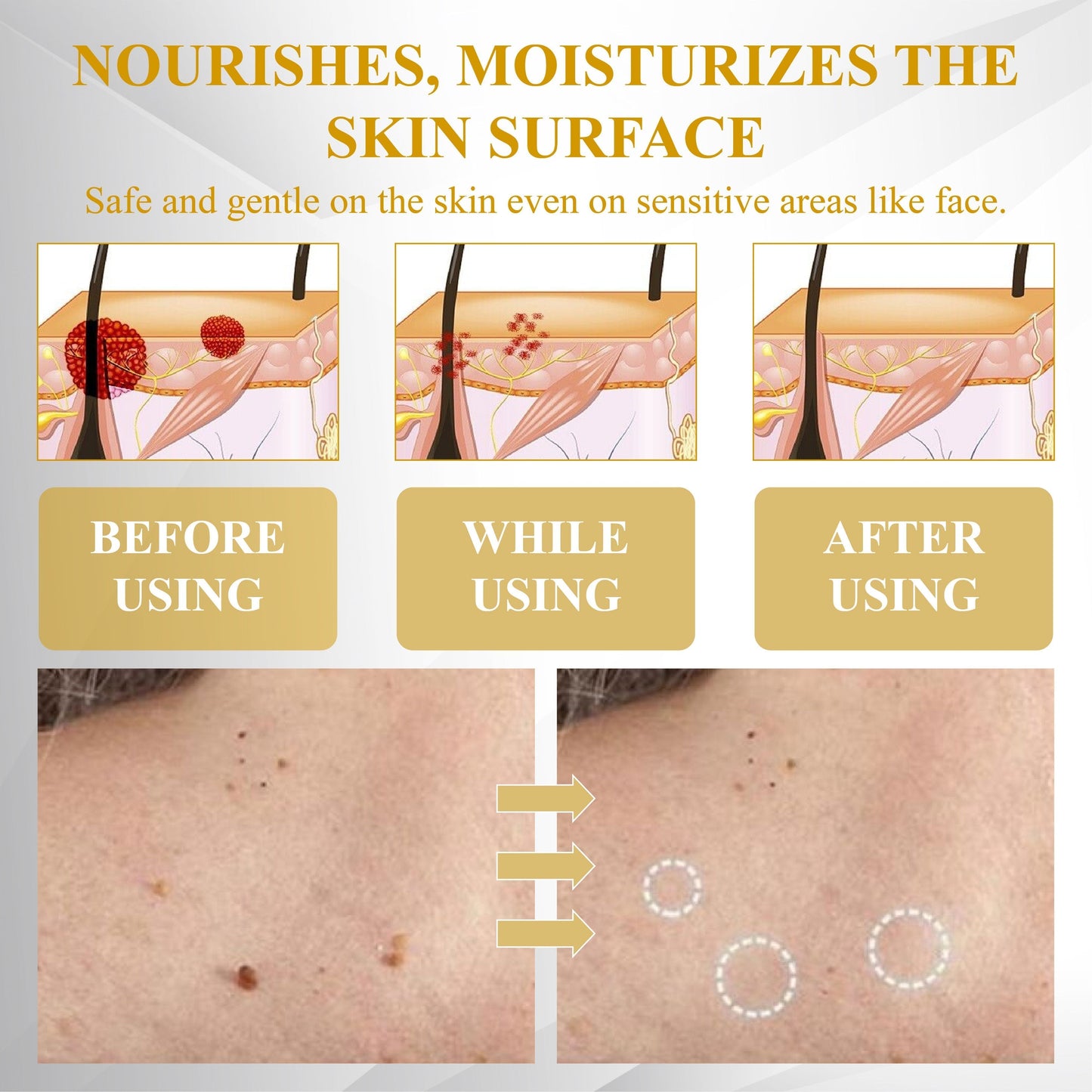 ATTDX® ApisCare Blemish & Tag Remover Stick