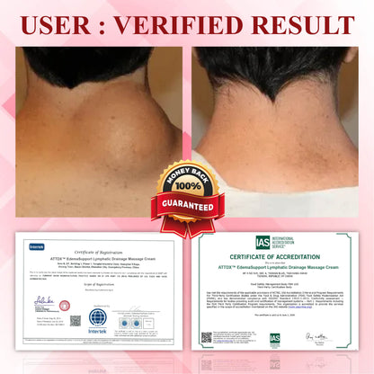 EdemaCare™ VeinRelief Lymphatic Massage Therapy Cream 2