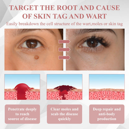 ATTDX® Wart & Spot Erase Advanced Particle Serum