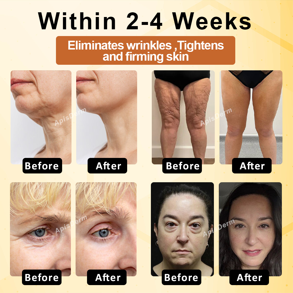 ApisThera™ BeeBotox Multi-Purpose FirmingCream