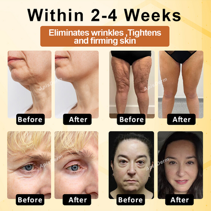 ApisThera™ BeeBotox Multi-Purpose FirmingCream