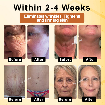 ApisThera™ BeeBotox Multi-Purpose FirmingCream